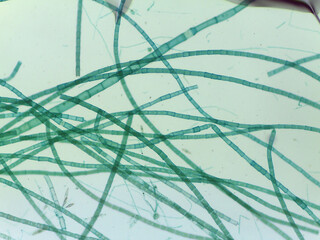 Microscopic View of Filamentous Algae (Oedogonium) with Potential Dwarf Male Filame