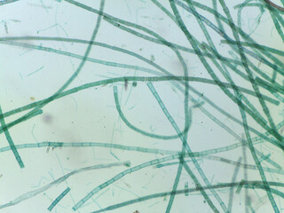 Microscopic View of Filamentous Algae (Oedogonium) with Potential Dwarf Male Filame