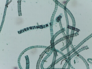 Microscopic View of the Filamentous Green Algae Ulothrix
