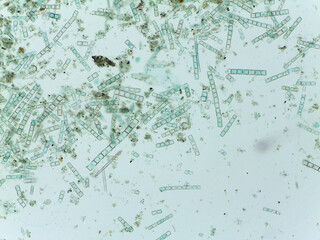 Microscopic View of the Filamentous Diatom Melosira Showing Auxospore Formation
