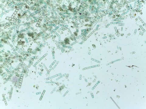 Microscopic View of the Filamentous Diatom Melosira Showing Auxospore Formation