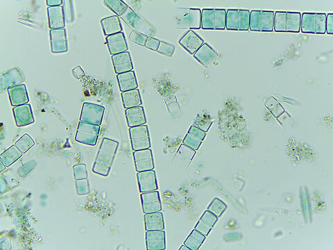 Microscopic View of the Filamentous Diatom Melosira Showing Auxospore Formation