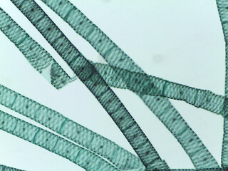 Microscopic View of Multiple Spirogyra Filaments Showing Segmented Cells and Spiral Chloroplas