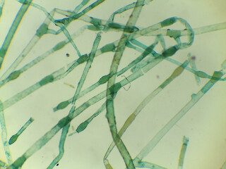 Microscopic View of the Filamentous Green Algae, Pithophora, Showing Akinet