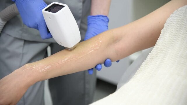 laser epilation, hair removal procedure, young beautiful caucasian smiling brunette woman lying on couch in beauty salon, arm epilation, spa and cosmetology concept