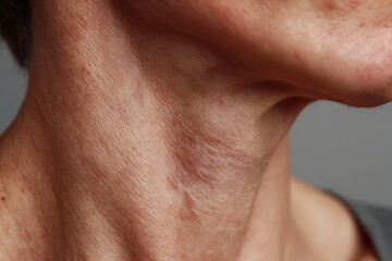 Fototapeta premium close-up neck skin adult, firm yet natural texture
