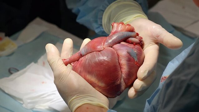 Medical Professional's Hand Covered in Sterile Surgical Gloves Carefully Holding a Anatomically Correct Human Heart