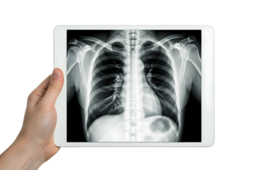 Hand holding tablet with chest xray isolated on transparent background