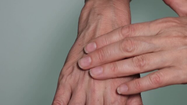 A close-up of a 58-year-old woman's hands, showing prominent veins. The subcutaneous fat layer is absent, the skin is thin, and the veins are visible through it. Cosmetology and plastic surgery.