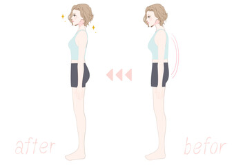 平背を整える女性の横向きビフォーアフター
