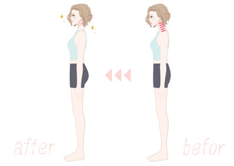 ストレートネックを整える女性の横向きビフォーアフター