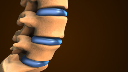 Spinal Disc Herniation Shown in Medical Animation
