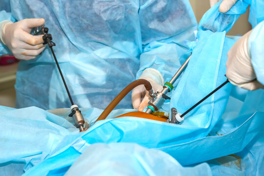 Surgical team performing minimally invasive procedure in an operating room setting
