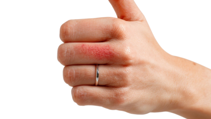 PNG of Close-up of a hand with a red mark, giving a thumbs up, demonstrating resilience despite minor injury.