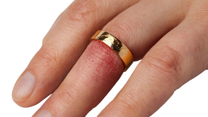 PNG of Close-up of a hand with a gold ring on a finger, highlighting the unique texture and design of the ring against the skin.