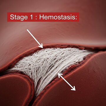 Stage 1 Hemostasis - Blood Clotting Process Illustration with Arrows.