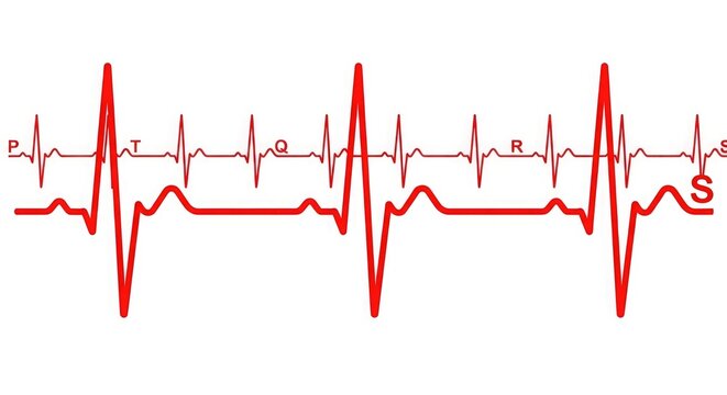 Electrocardiogram or ecg waveform showing heart rhythm and electrical activity