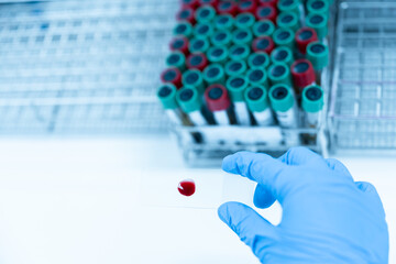 Selective focus doctor or lab technician hand wear blue gloves hold human red blood on slide for malaria test (thick film),blood group test,complete blood count(CBC)with microscope in laboratory.