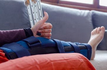 Close up woman with a broken leg doing thumb up.