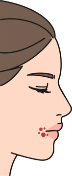 vector illustration of woman with rickets