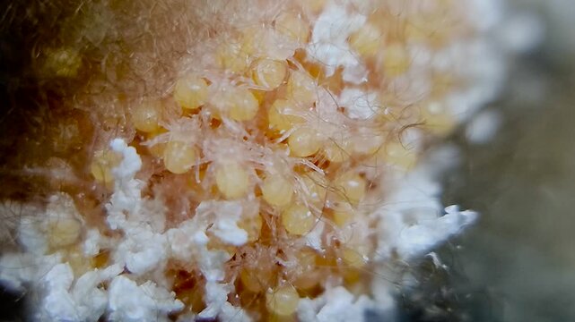 한국,거미,부화,새끼거미,알집,Korea, spider, baby spider, egg, incubation
