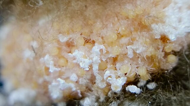 한국,거미,부화,새끼거미,알집,Korea, spider, baby spider, egg, incubation