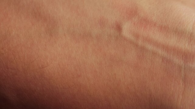 Hand skin texture close-up. Veins on hand. Healthcare, medicine concept.