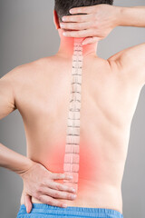 Lumbar and cervical spine hernia, man with back pain, compression injury of the intervertebral disc