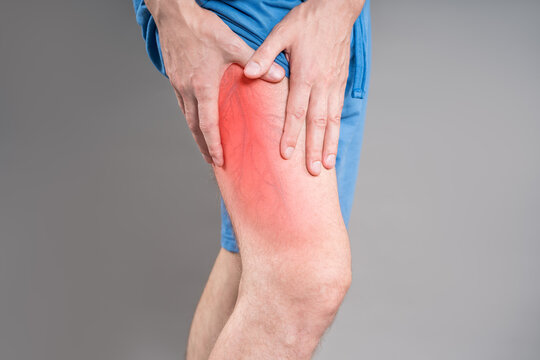 Varicose veins on male leg - medical photo of visible swollen veins, vascular disease concept