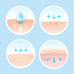 Multiple layers skin with drops and arrows for skin health-related project. Vector illustration isolated on white background. Great for infographics, showing the action of your product. 