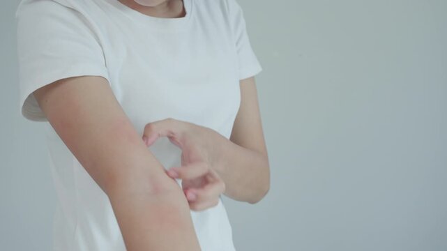 skin problem and beauty. Young woman scratch body has itchy skin from skin allergic, steroid allergy, sensitive skin, red from sunburn, chemical allergy, rash, insect bites, Seborrheic Dermatitis.