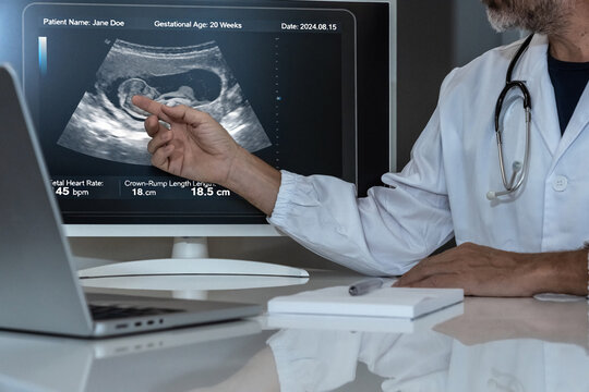 Obstetrician analyzing 20-week fetal ultrasound scan and patient data on a monitor