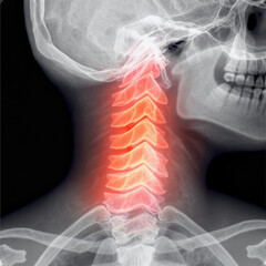 x ray image of human head