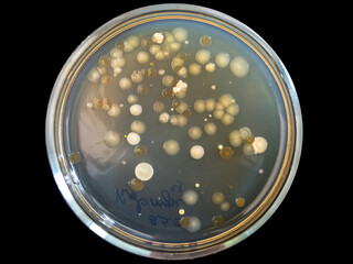Petri dish with bacterial colonies on black background.