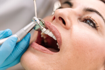 Close up of Dentist polishing teeth of female patient in dental clinic