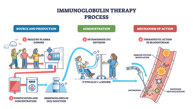 Immunoglobulin therapy process visualizes donor plasma to IV infusion and antibody action in blood, key objects, donors, IV bag, vein with antibodies. Outline diagram