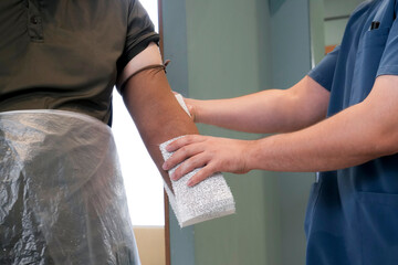 Applying a bandage with plaster, Taking an impression of an injured human hand by a specialist prosthetist doctor, to make a custom prosthesis for the forearm and hand