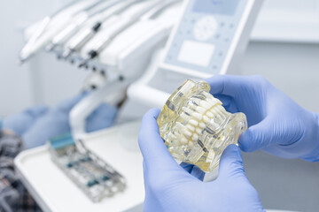 Dentist holding implant jaw model during consultation in modern clinic © st.kolesnikov
