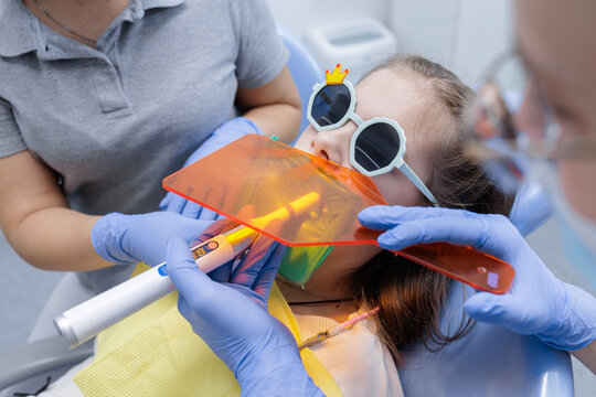 Pediatric light curing with orange shield and rubber dam during child dental restoration - Powered by Adobe