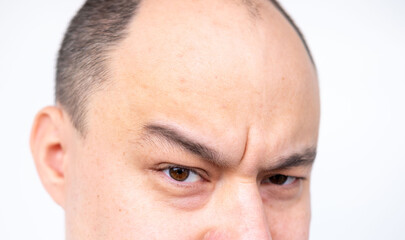 Fototapeta premium Closeup portrait Angry man with brown eyes and shaved head, man 35 years old expressing stress and frustration, aggressive reacting with anger and tension, natural skin texture, human forehead