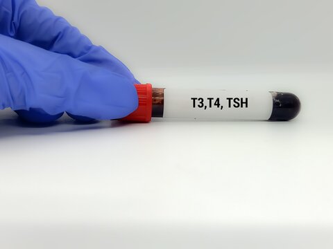 Doctor  holding a test blood sample for T3, T4,TSH - test. Laboratory medical testing concept.