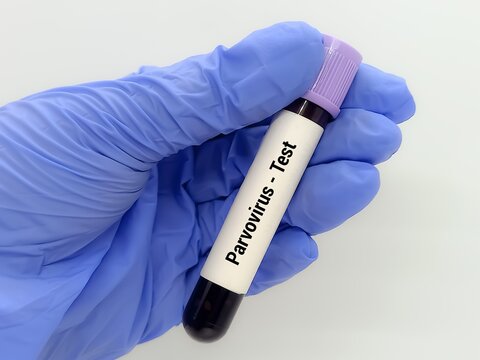Doctor  holding a test blood sample for Parvovirus  - test. Laboratory medical testing concept.