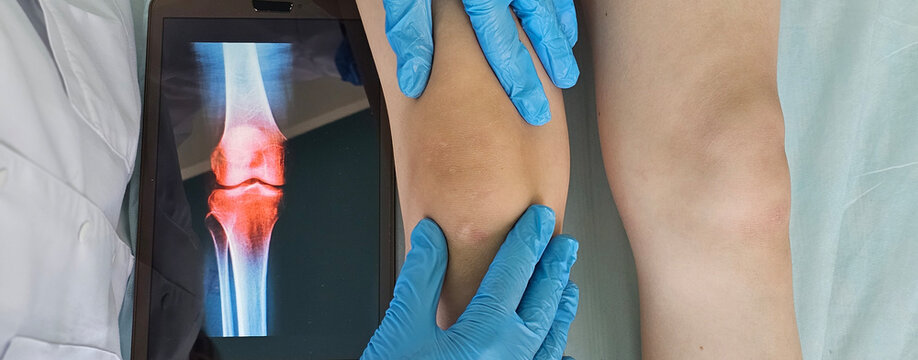 Surgeon examines x-ray of anatomy of foot