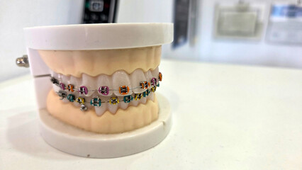 Dental training model with colorful braces for orthodontic education. Horizontal banner. Copy space