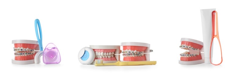 Set of jaw models with dental braces and tools for oral hygiene on white background
