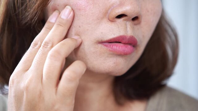 woman in middle age with visible pores, smile lines, dark spots, and skin damage on her face. Concept of natural aging, skincare awareness, wrinkles, and mature skin health