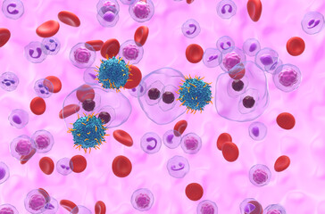 CAR T cell therapy in Hodgkin lymphoma (HL) - isometric view 3d illustration