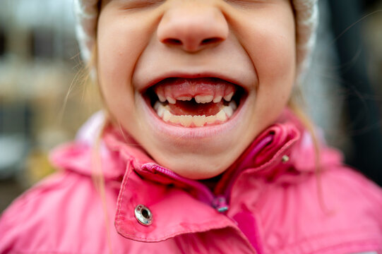 Happy girl showing gap toothed