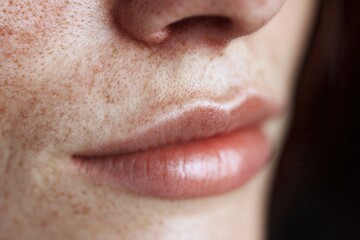 Obraz premium Authentic skin details in natural light.