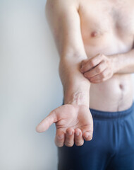 Man with red itchy rash over body from acute allergic reaction showing inflamed spots and skin irritation.